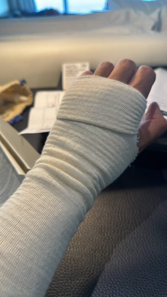 سرقة ساعة ثمينة من يد إعلامي سعودي في اسبانيا … والسفير يعلق