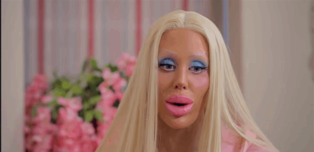 نتيجة كارثية.. بالصّور ـ أنفقت ثروة لـ تُصبح “Barbie”!